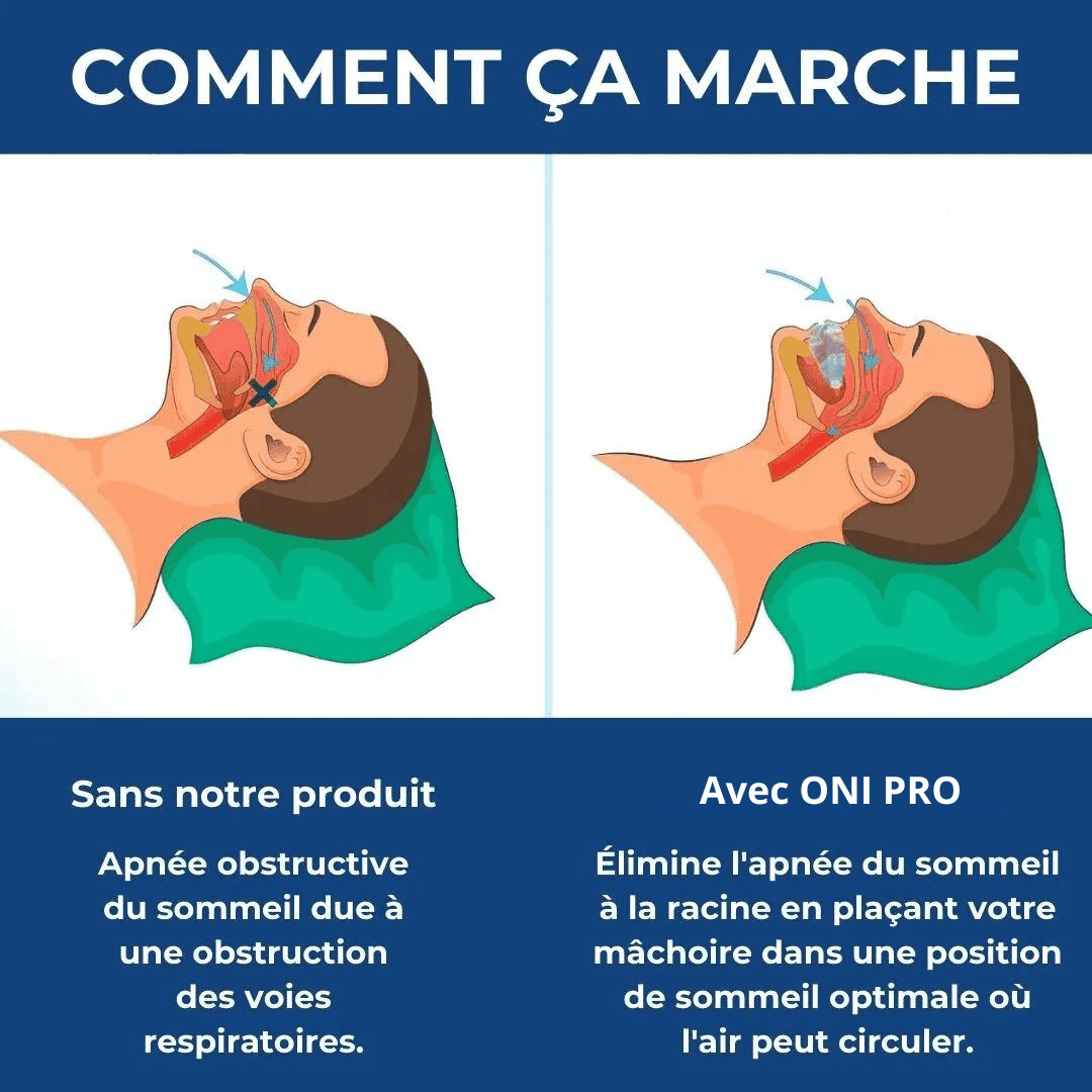 Arrête le ronflement pour une meilleure santé et un sommeil plus profond